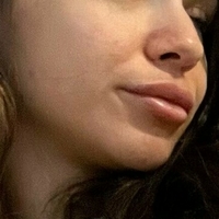 asxxo Alaston
