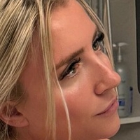 blondeadobo Alaston