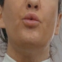 khloeefit Alaston