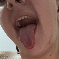 lyss98 Alaston