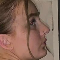myamaexo Alaston
