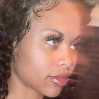 Rihannasforehead9 Alaston