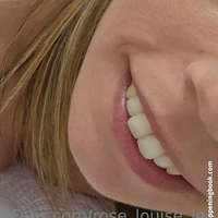 rose_louise_lee Alaston