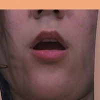 tessafoox Alaston