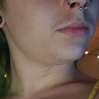 xxxanthisma Alaston