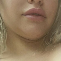 Your Neko Baby Alaston